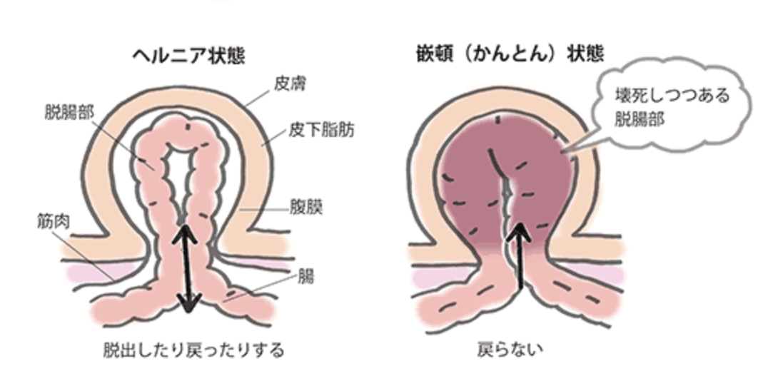 VIO脱毛｜なかにし形成外科クリニック