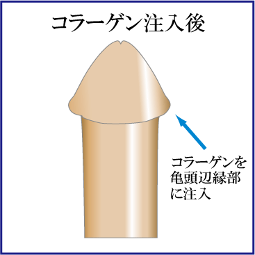 【カリ高】ペニスの亀頭特化カリトレ・チントレ方法は本当に効果があるのか解説！