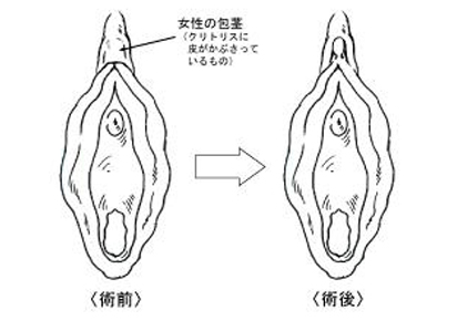 クリトリスの場所はどこ？構造・役割と快感を感じるためのいじり方 | Ray(レイ)