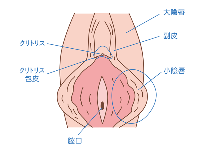 クリトリス包茎 - 美容外科｜船橋中央クリニック&青山セレスクリニック