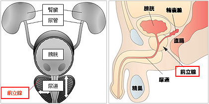 前立腺マッサージは医療行為！ 残尿感や排尿痛に悩む男性が急増、その不快感は前立腺炎かも？ - ライフ・文化