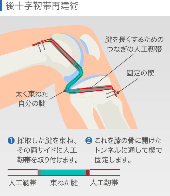 膝を伸ばさないで」の本当の意味 | コアギャラリー小川