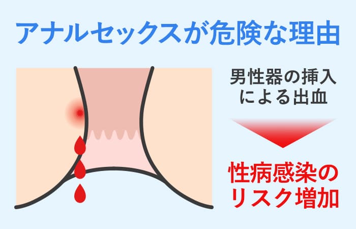 アナルに中出しすると病気になる！？メリット・デメリットを解説｜風じゃマガジン