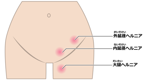 男をアゲるSKB！鼠径部マッサージをより効果的にする前準備とは？【エステ図鑑東京】