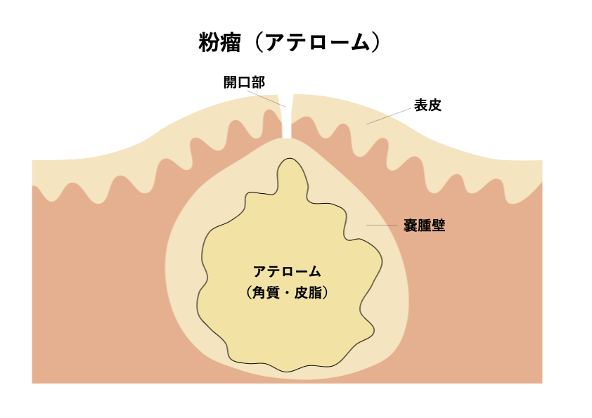 男児の性教育】思春期に身につけたい「正しいマスターベーション」の作法とは 専門医がくわしく解説 - コクリコ｜講談社