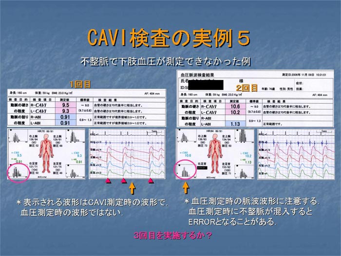 間歇性跛行の検査（ABI検査）が出来ます | まつだ整形外科