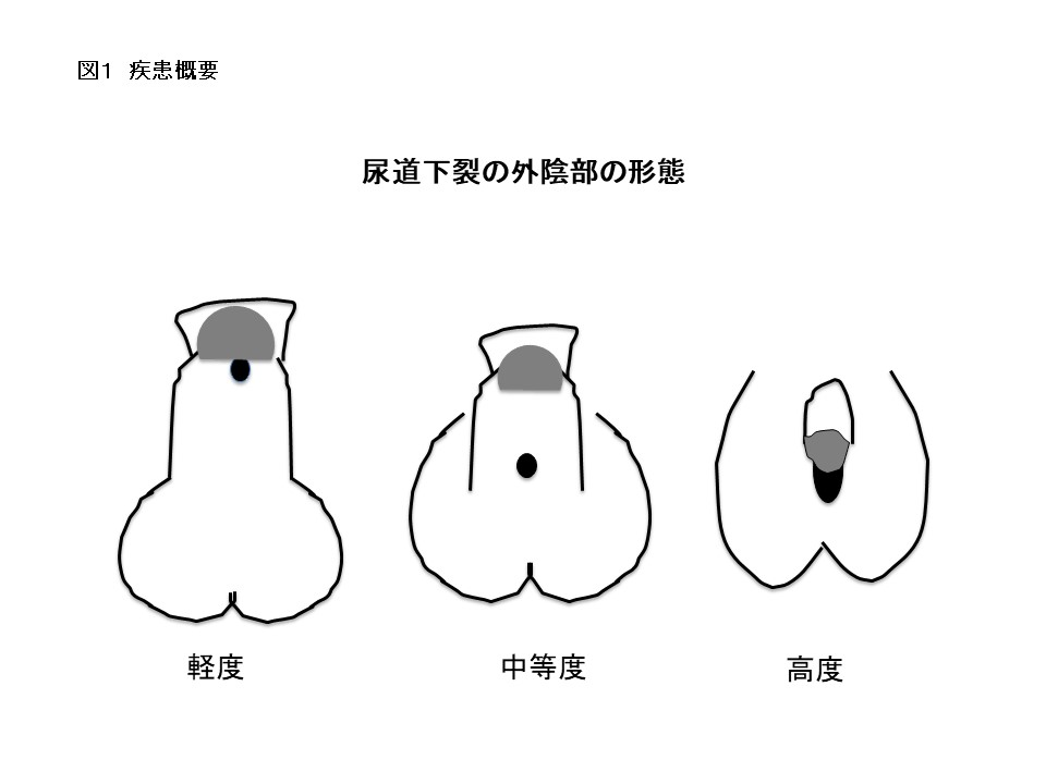 Gスポットはどこにある？ない人もいる？ 見つけ方・開発方法を紹介 | 医師監修 ｜