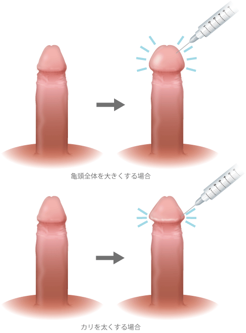 デカチン計画】トレーニングで巨根を手に入れる。ペニス増大で満足度UP｜あんしん通販コラム