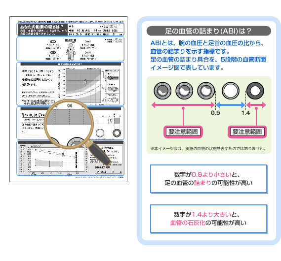 顧客レポート | フットケア |