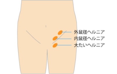 慢性腹痛 | 愛知県岡崎市