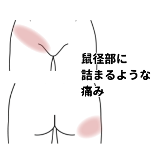 鼠径部痛症候群（グローインペイン） | 市川市