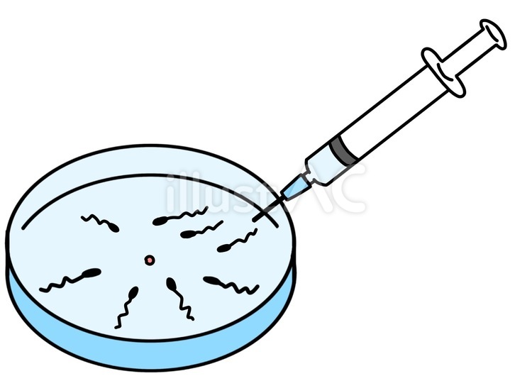 精液検査〜実践編〜 | 田中レディスクリニック渋谷
