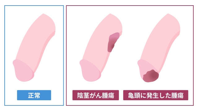 図入りで分かりやすく説明。女性器の名称と役割