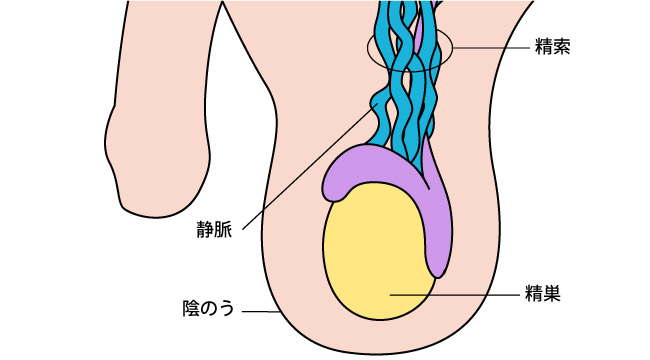 デリケートゾーンに黒ずみがあるとVIO脱毛はNG？黒ずみの原因と解消法も解説 - トイトイトイクリニック