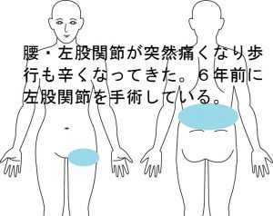 ぎっくり腰が一日で治った？歩けるけど痛いときの知恵袋 - 整体の操和｜沖縄県浦添市の痛みと痺れの整体院