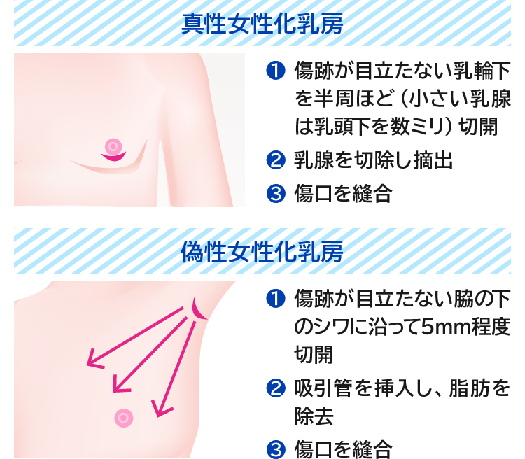 Amazon.co.jp: Vibrator, Nipple Attack, Adult