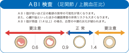 動脈硬化検査を受けられた方へ｜ふじみ野市の内科・循環器内科【飯田医院】