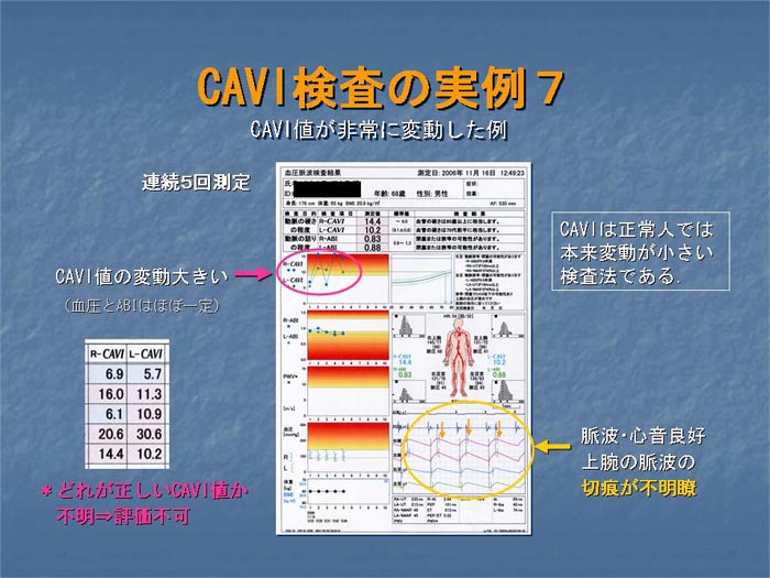 血圧脈波検査（ABI）とは | 室岡整形外科記念病院