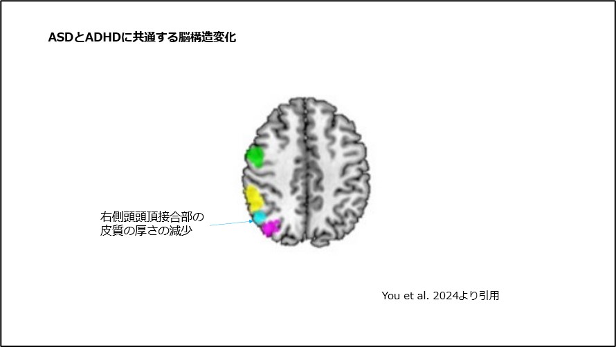 性別確認手術 あなたの性別を確認する手術 | Bangkok