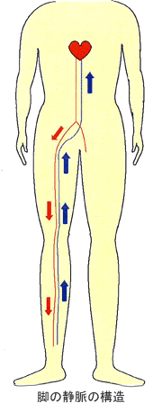 動脈硬化が足の血管に起こったら…末梢動脈疾患（閉塞性動脈硬化症） | 血管治療外来のご案内 |