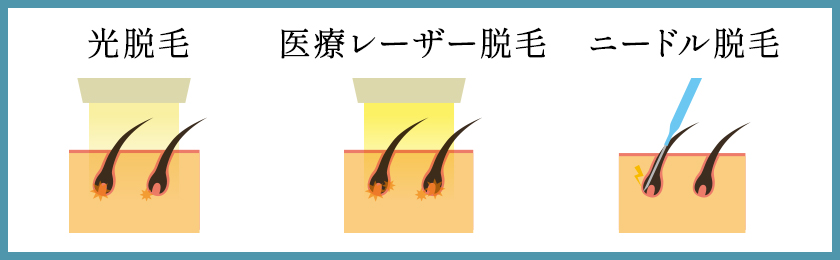 抜けるエロ画像】ピンピンになったチンコ諸ともぶっこ抜くべ（30枚） | エロ画像ギャラリーエロ画像ギャラリー