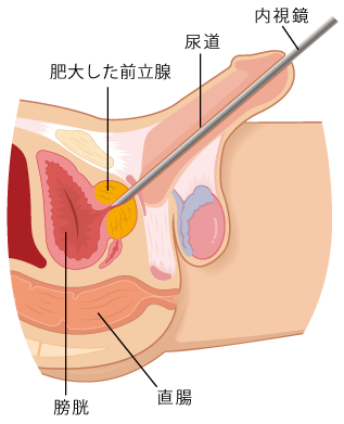 前立腺オナニーとは？快感を得られるやり方と危険性について解説！｜風じゃマガジン