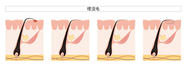 何故、眉毛が生えてこないのか？原因と対処法について | メンズ