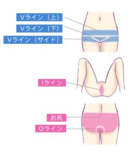 美穂のお仕置き 1巻2巻 セット -