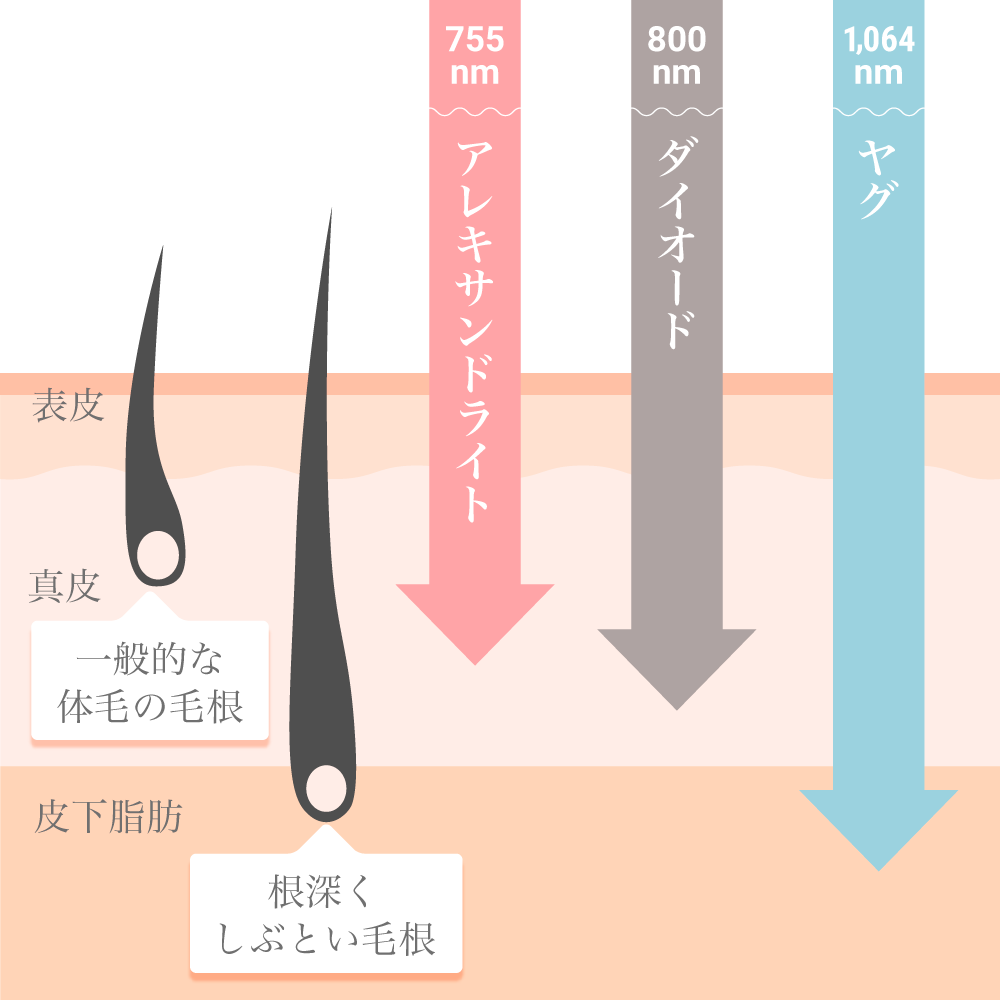 パイパン の検索結果（29作品）:DEEP'S - ディープス