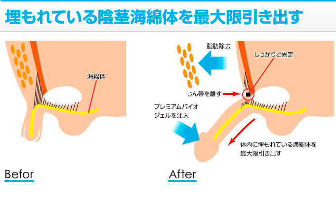 ペニスのサイズ（短小・巨根）について とある女性の意見 - TENGAヘルスケア プロダクトサイト