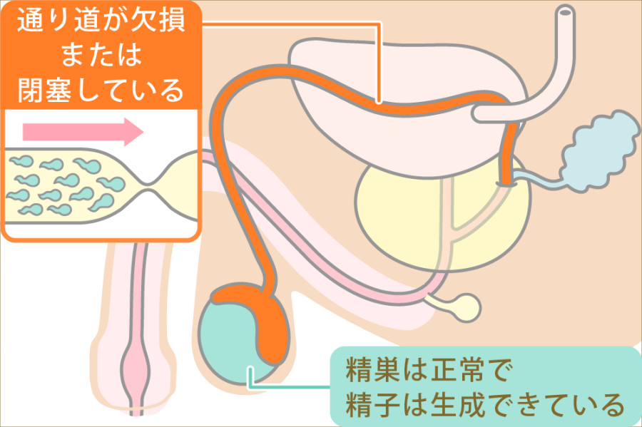 射精管理されてるm男が貞操帯を着けたままローター焦らし責めで大量射精! エログちゃんねるニュース - 貞操