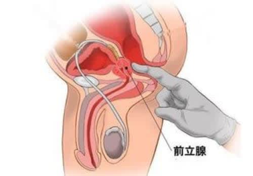 前立腺責めのやり方とコツ！気持ちいい前立腺マッサージの方法をイラストで解説