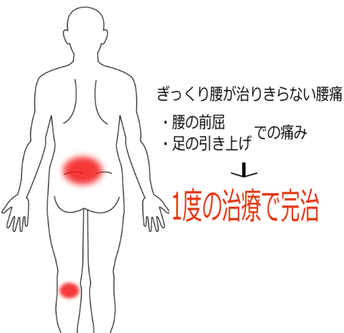 姿勢矯正ベルト 子供 猫背矯正ベルト 効果 男性