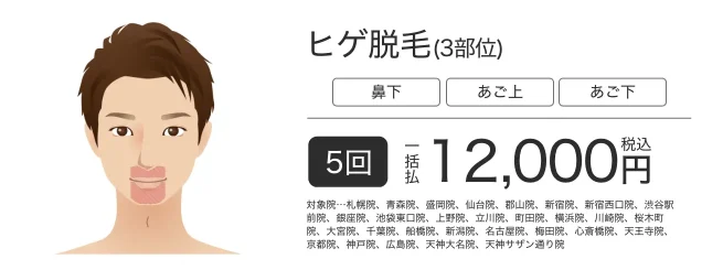 メンズ脱毛サロンYES大阪梅田店 | ヒゲ脱毛サロン【YES】男性顔脱毛の品揃え最大級