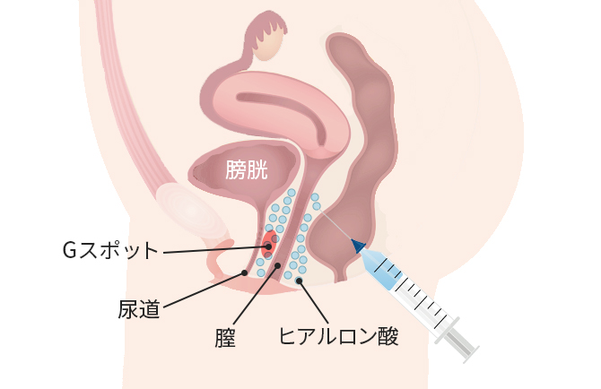 Gスポットを開発してイク方法を徹底解説！感じない女性でもイケるバイブでの刺激の仕方【快感スタイル】