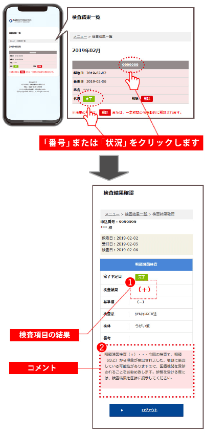 口コミまとめ】匿名でできる！性病検査キット｜梅毒（男女兼用）|GME医学検査研究所 | 性病検査キット比較サイト