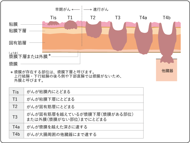 PET健診 最前線レポート⑤