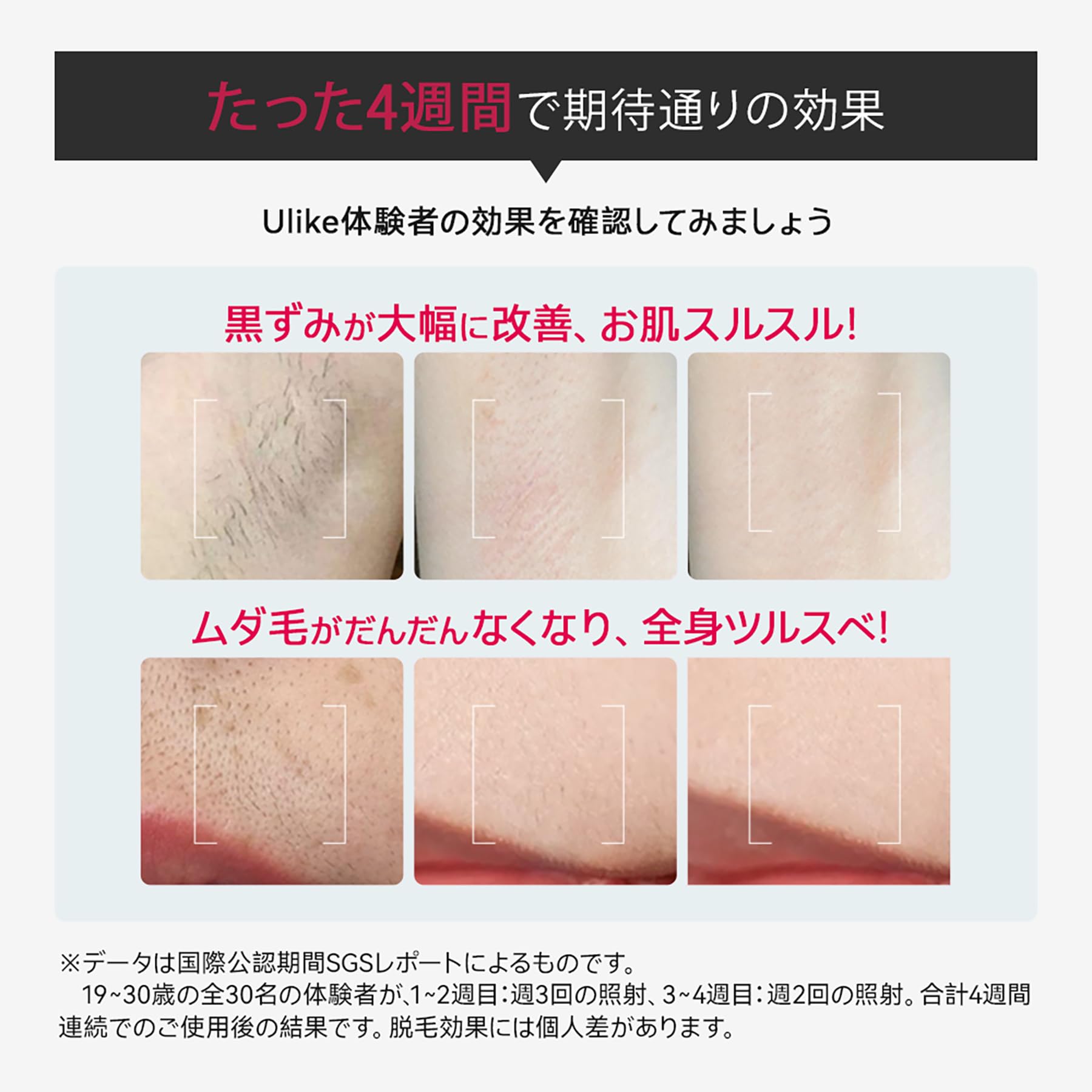 Ulike Rose IPL 脱毛器 美顔器